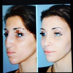 شعار تجميل اسطنبول