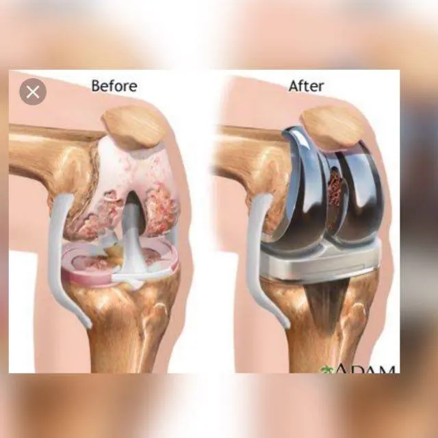 طب العظام بالهندكل خدمة - Groupe WhatsApp